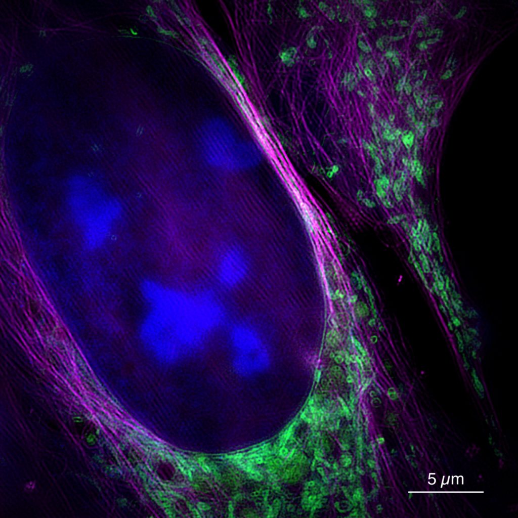 Diese Aufnahme des neuen Mikroskops zeigt eine lebende Knochenkrebszelle mit Zellkern (blau), Mitochondrien (grün) und Zytoskelett (magenta). Foto: Universität Bielefeld/W. Hübner